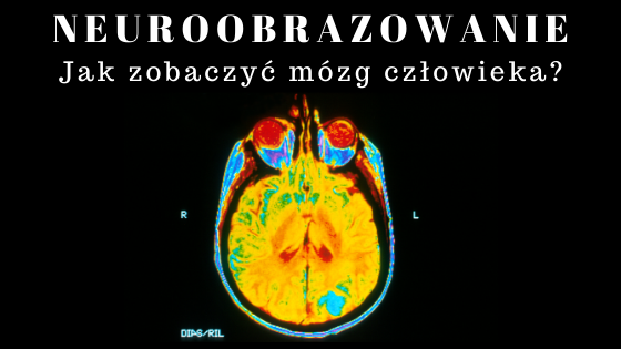 Neuroobrazowanie - jak zobaczyć mózg? • Neuronaukowiec.com